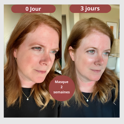 LuminaGlow™-Masque Visage Bio-Collagène